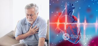 Doctor tells what causes a heart attack