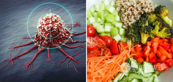 Nutritionist explains what kind of food prevents colon cancer