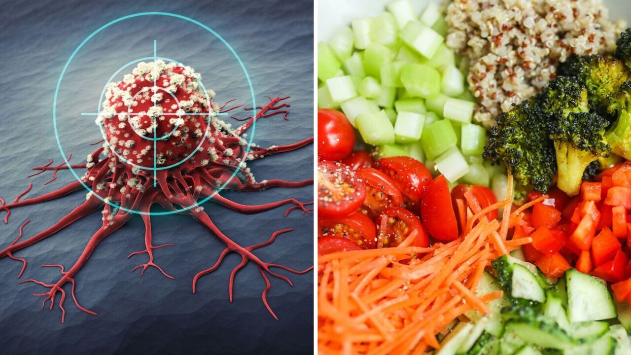 Nutritionist explains what kind of food prevents colon cancer