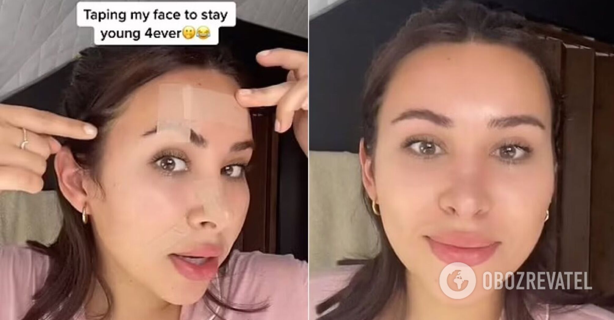 Saving from wrinkles? A woman shows an affordable alternative to Botox and conquers the web: the video goes viral
