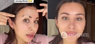 Saving from wrinkles? A woman shows an affordable alternative to Botox and conquers the web: the video goes viral