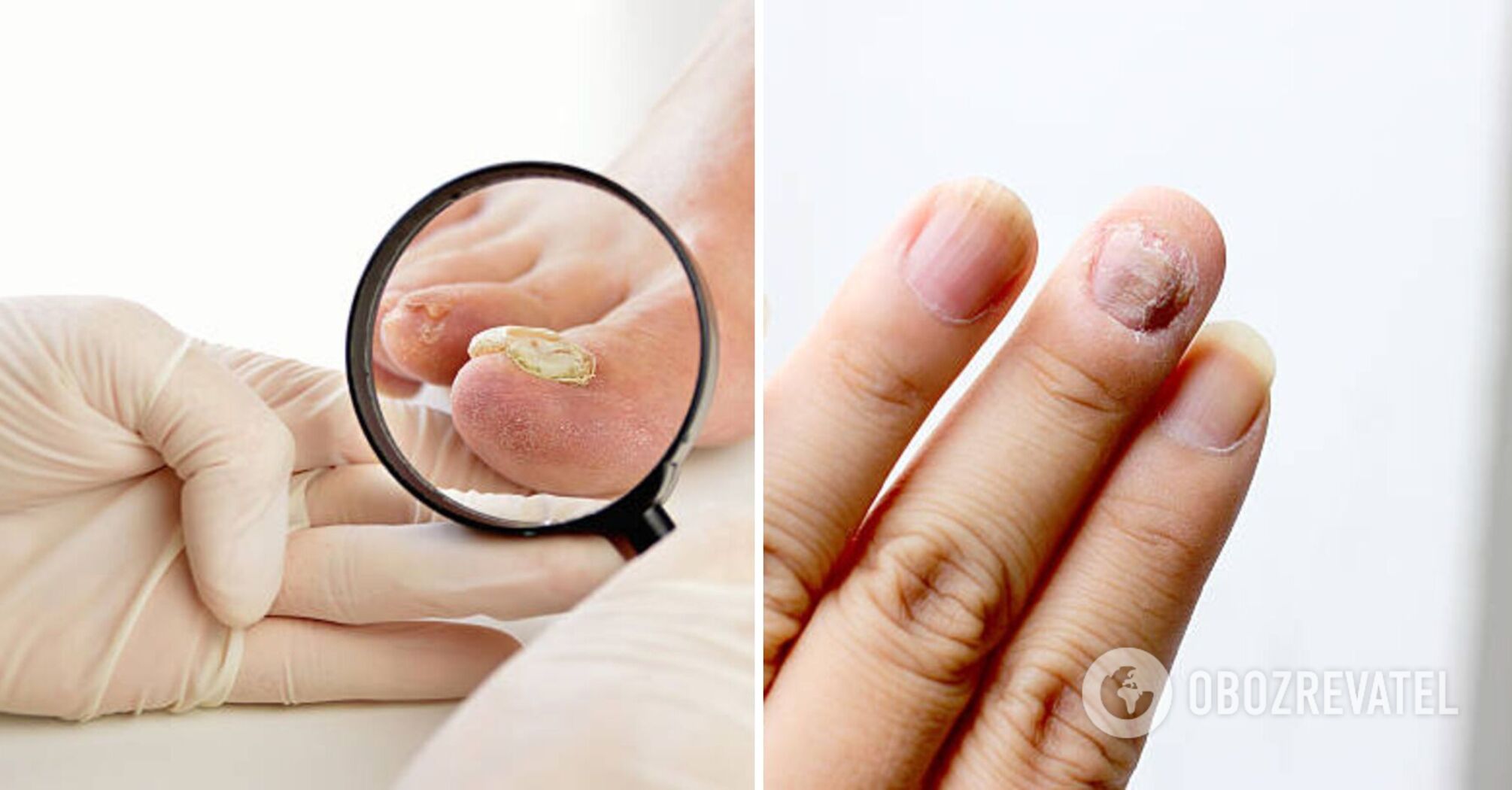 Experts tell us what the appearance of your nails can indicate