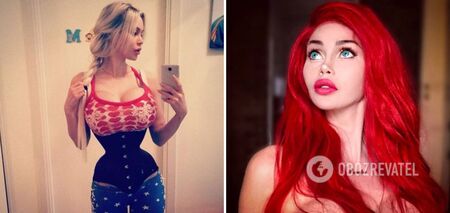 She removed 6 ribs for a 36cm waist: what a Barbie girl looks like who was almost killed by plastic surgery. Photos before and after surgery