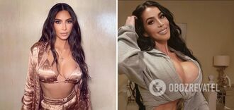 A 34-year-old Kim Kardashian look-alike passed away after plastic surgery. Photo
