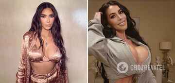 A 34-year-old Kim Kardashian look-alike passed away after plastic surgery. Photo