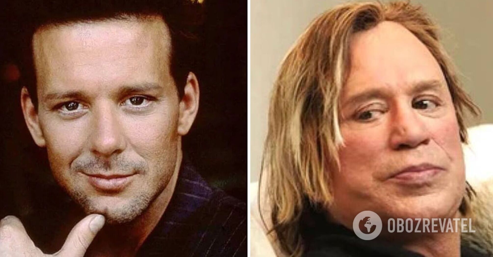 They were admired by millions: five famous actors who have changed beyond recognition. Photo by