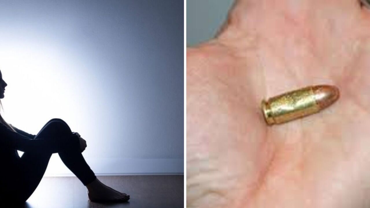 In Somalia, a girl got a stray bullet in her vagina and it stuck in her clitoris. Photo.