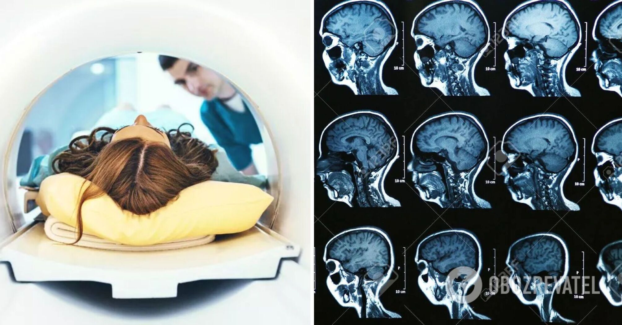Scientists have learnt to "read" human thoughts: how they did it | OBOZ.UA