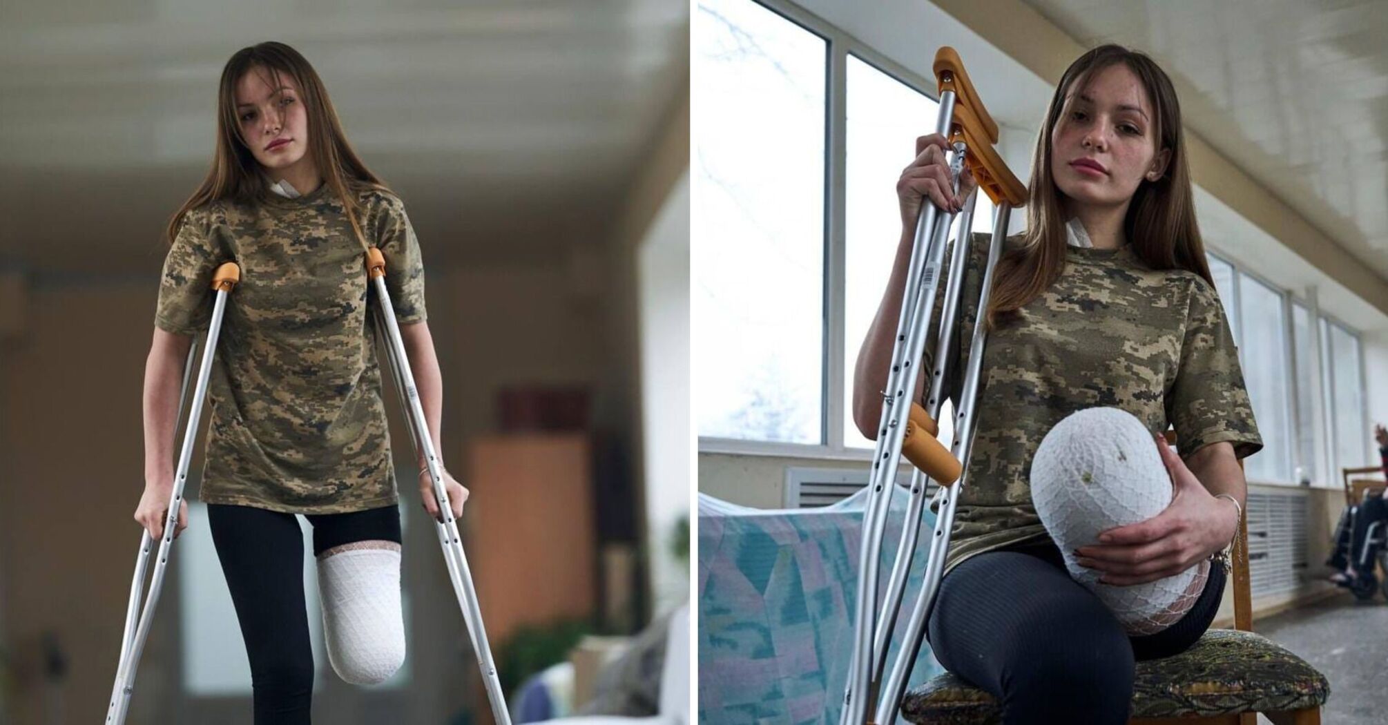 "She became a symbol of invincibility": the network told about a young defender of Ukraine who lost her leg in the war but did not give up