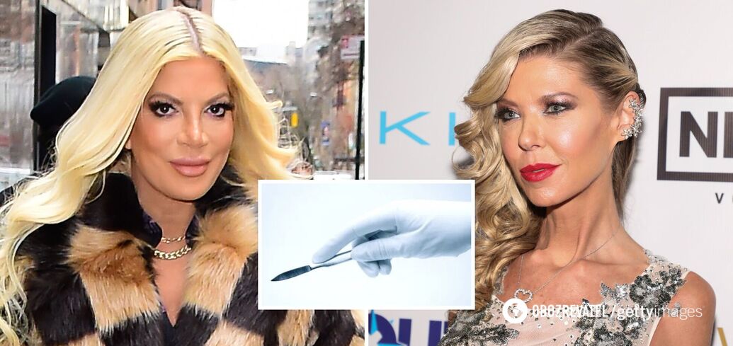Everything went wrong! 6 stars whose careers were ruined by bad plastic surgery. Photos before and after