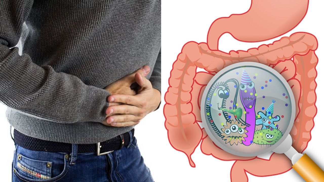 Irritable bowel syndrome: doctors told about early symptoms
