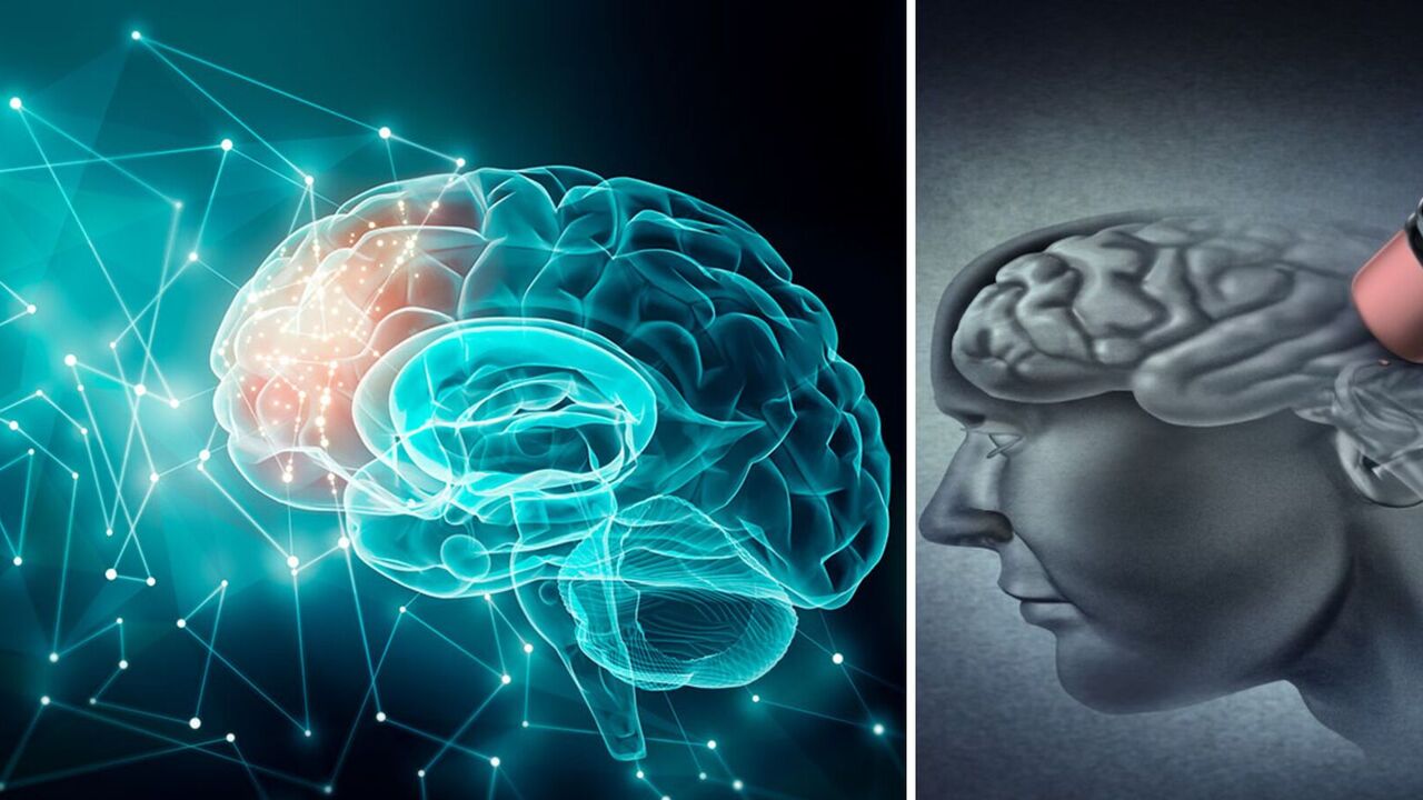 Wcześniej nieznana struktura anatomiczna w mózgu, która może chronić przed chorobą Alzheimera