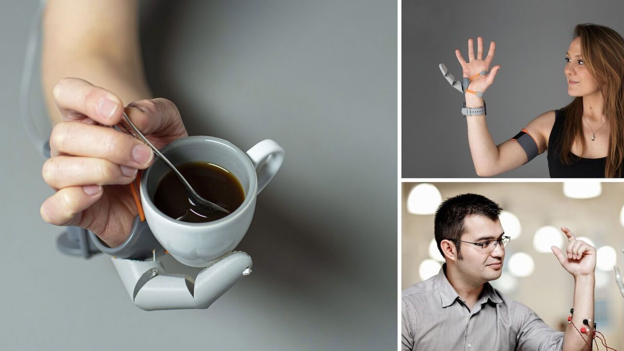 People can get an extra arm, wings and tentacles: what scientists are up to