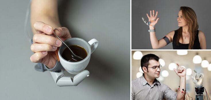 People can get an extra arm, wings and tentacles: what scientists are up to