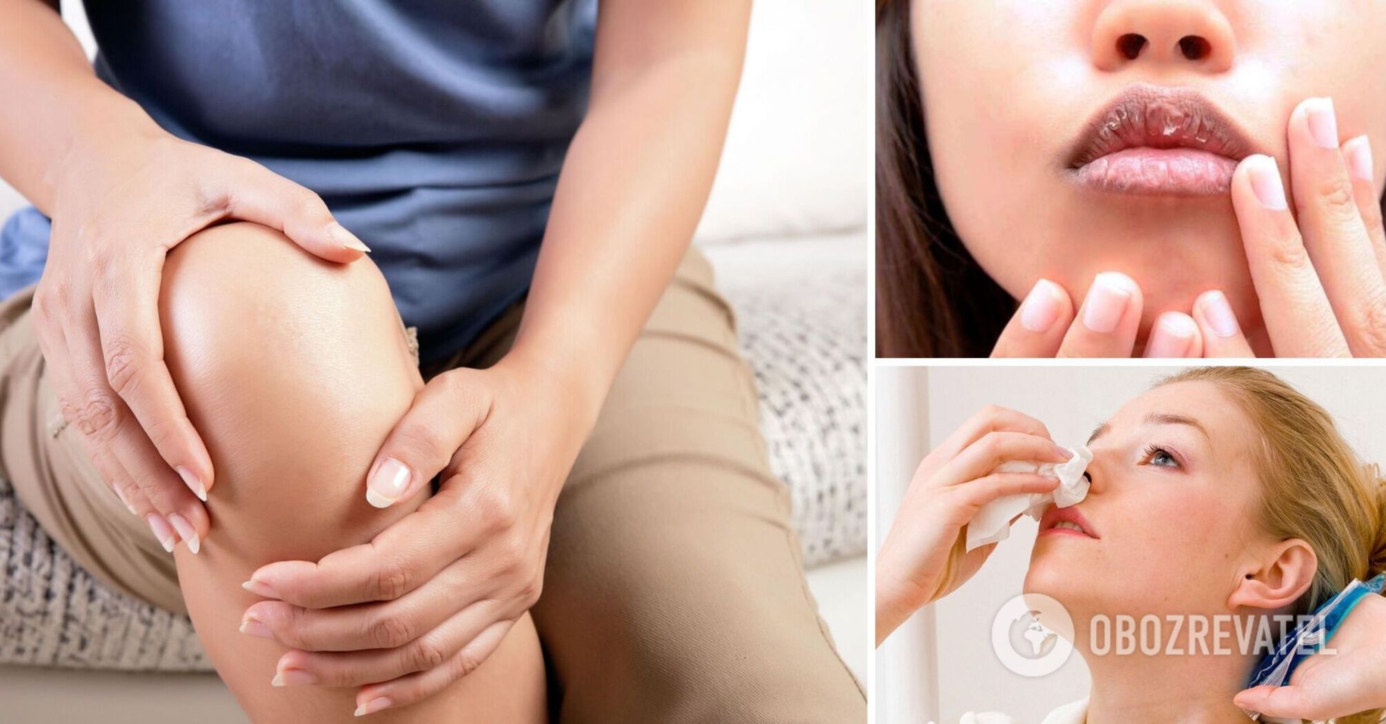 What symptoms are indicative of the disease