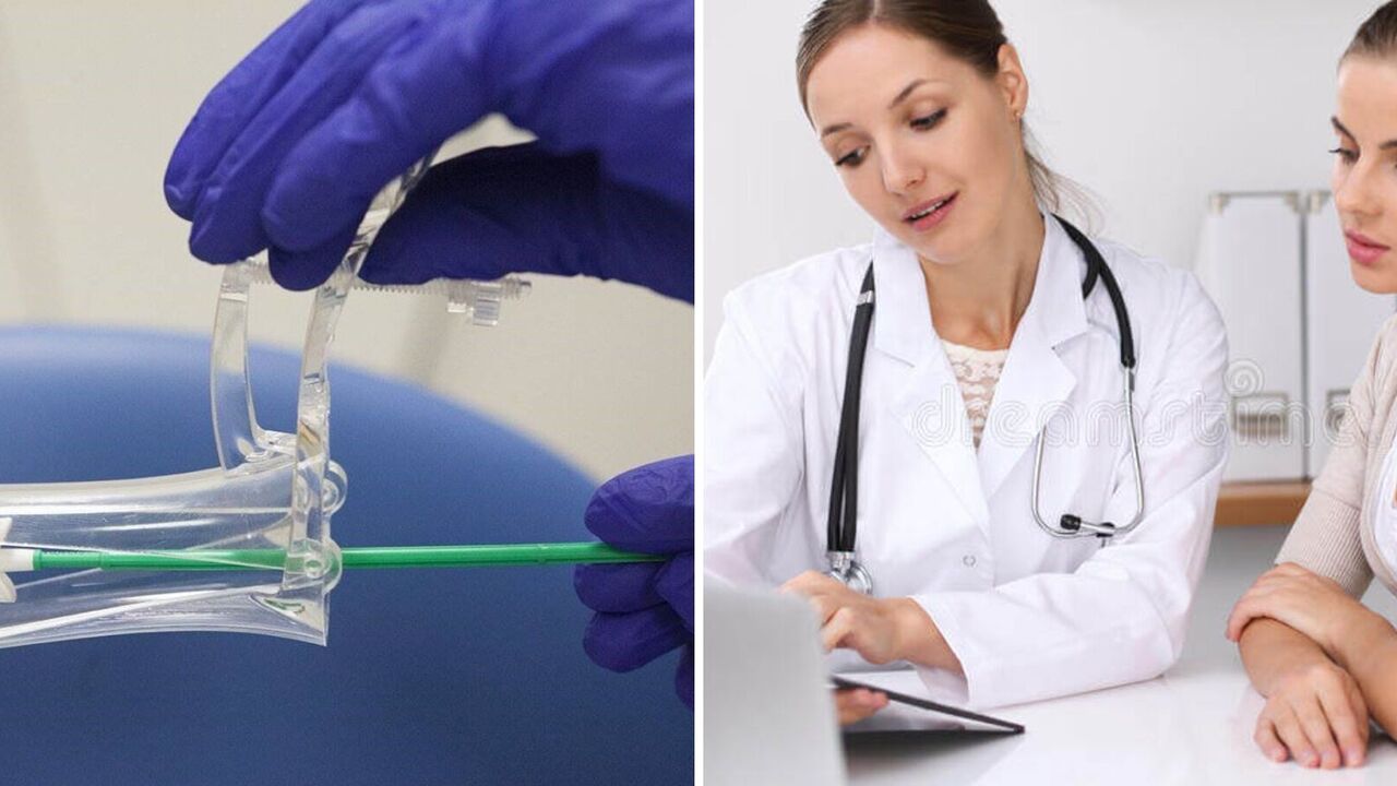 The Ministry of Health reminded women about the PAP test for cervical cancer, which is free of charge