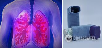 Lekarze zidentyfikowali sygnały choroby płuc, których nie należy ignorować