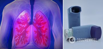 Doctors name lung disease signals that should not be ignored