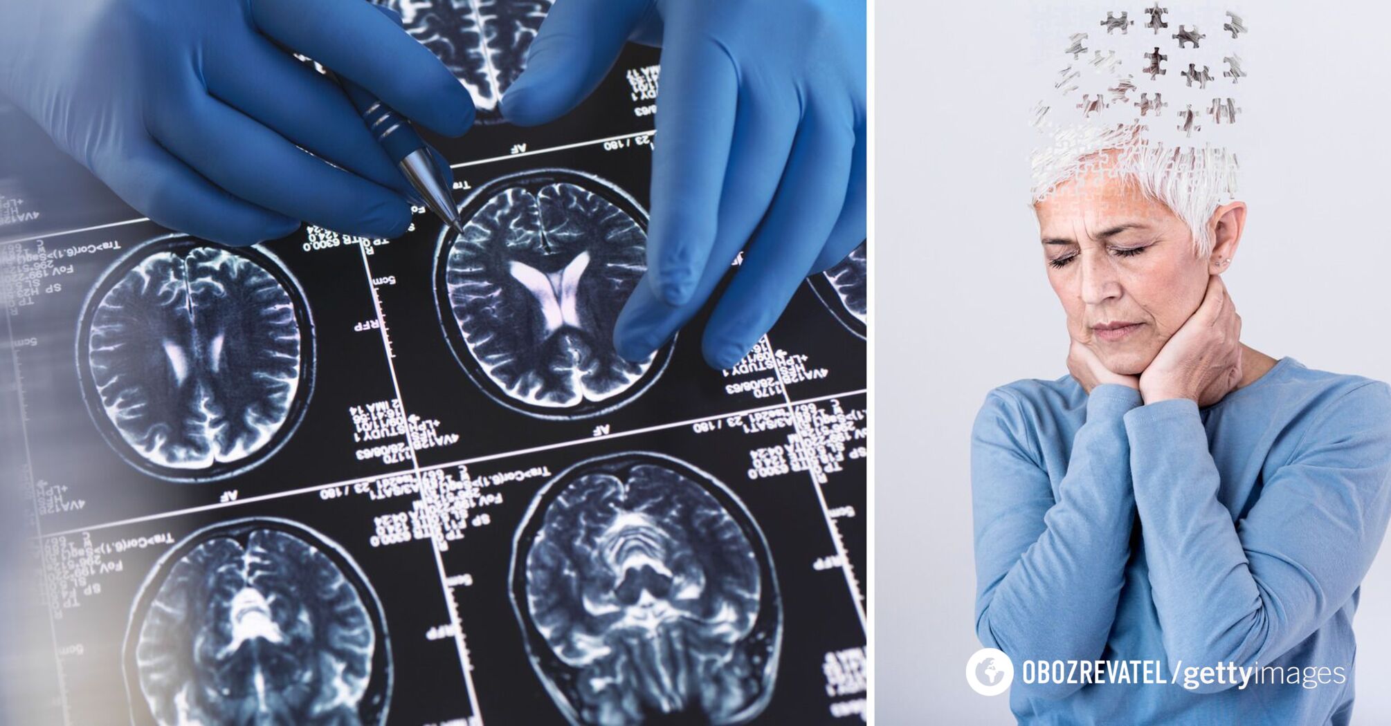 How to Slow Down Brain Aging - Advice from Scientists