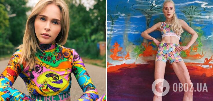 She paid $160 thousand to have her bones broken: what a model looks like who dared to take a crazy step for the sake of beauty. Photo.