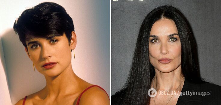 They aged themselves with plastic surgery: Demi Moore, Madonna and other celebrities who have changed themselves beyond recognition