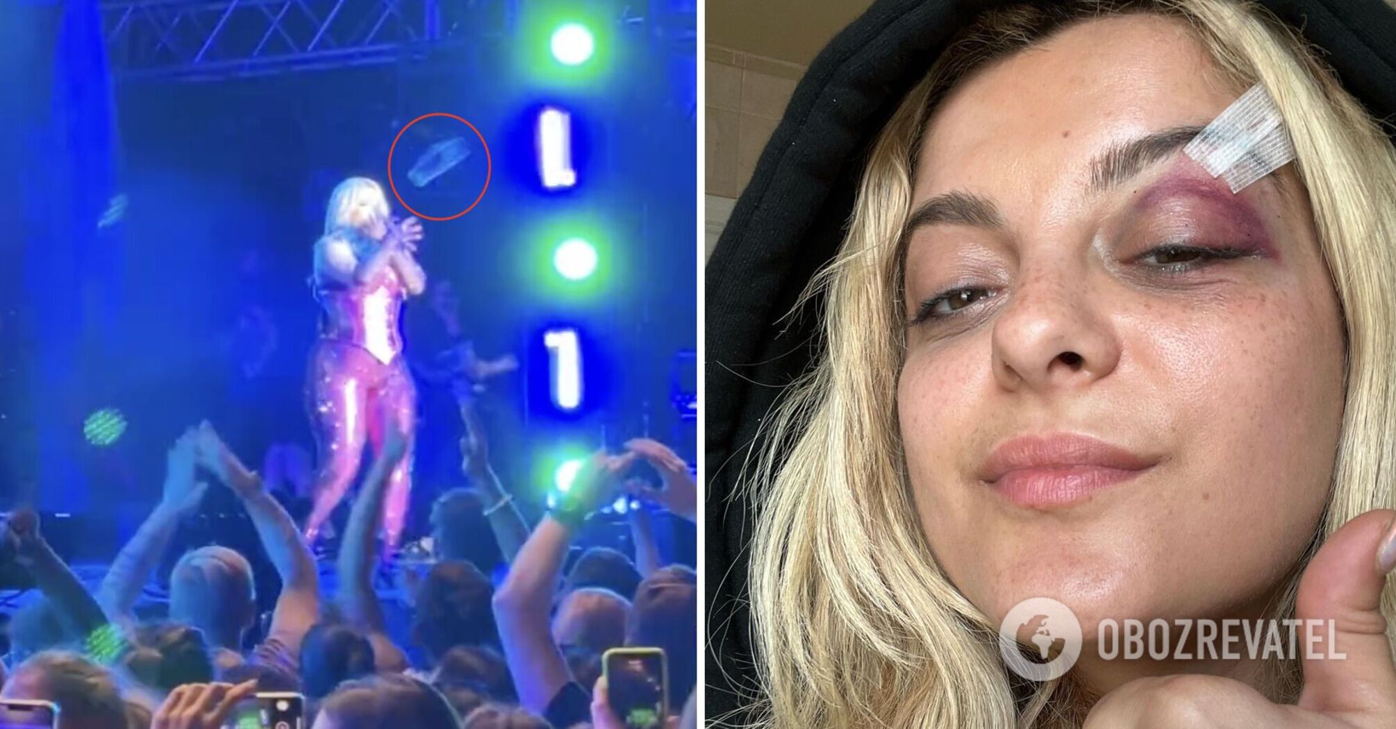 A fan threw a phone at the popular singer's head and knocked her down: he was detained, and the star showed the consequences on her face