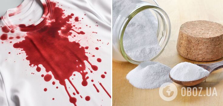 Jak usunąć plamy krwi z ubrań: produkt kuchenny pomoże