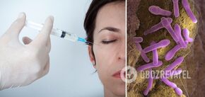 Beauty shots can be fatal: scientists found Botox penetrating the brain
