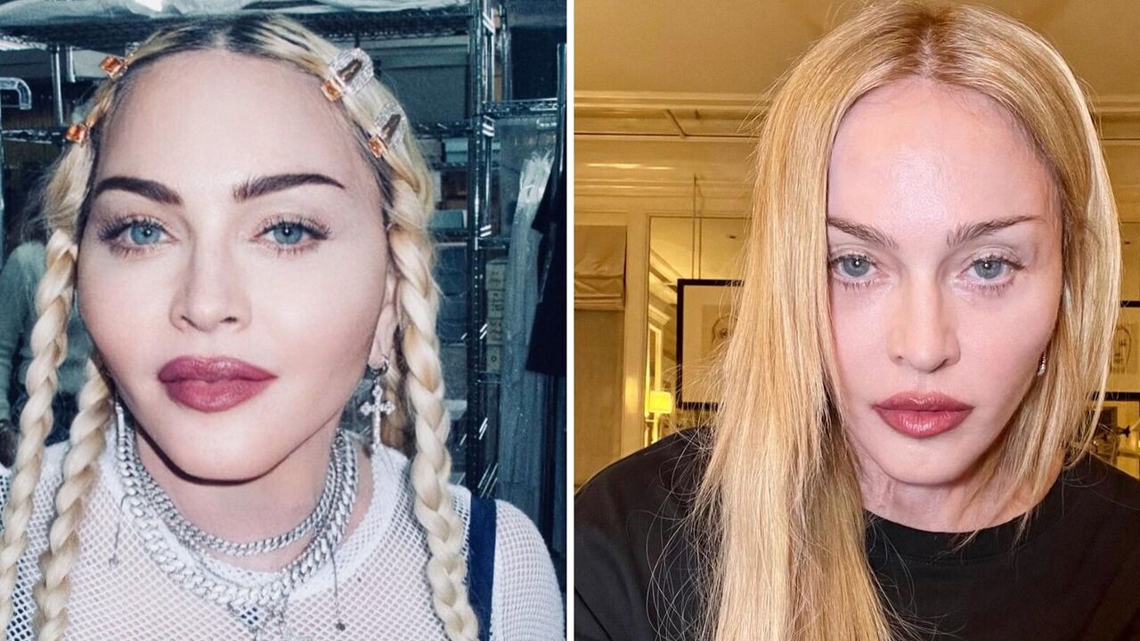 Madonna skontaktowała się po raz pierwszy od czasu hospitalizacji i ujawniła, jak zmieniła ją choroba. Zdjęcie