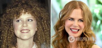 Ukrywanie niedoskonałości uśmiechu: 5 gwiazdkowych piękności, które mają sztuczne zęby. Zdjęcia przed i po