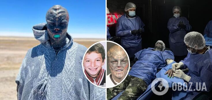 "Czarny kosmita" bez uszu i nosa pokazał, jak wyglądał w wieku 13 lat przed licznymi operacjami i tatuażami. Imponujące zdjęcia