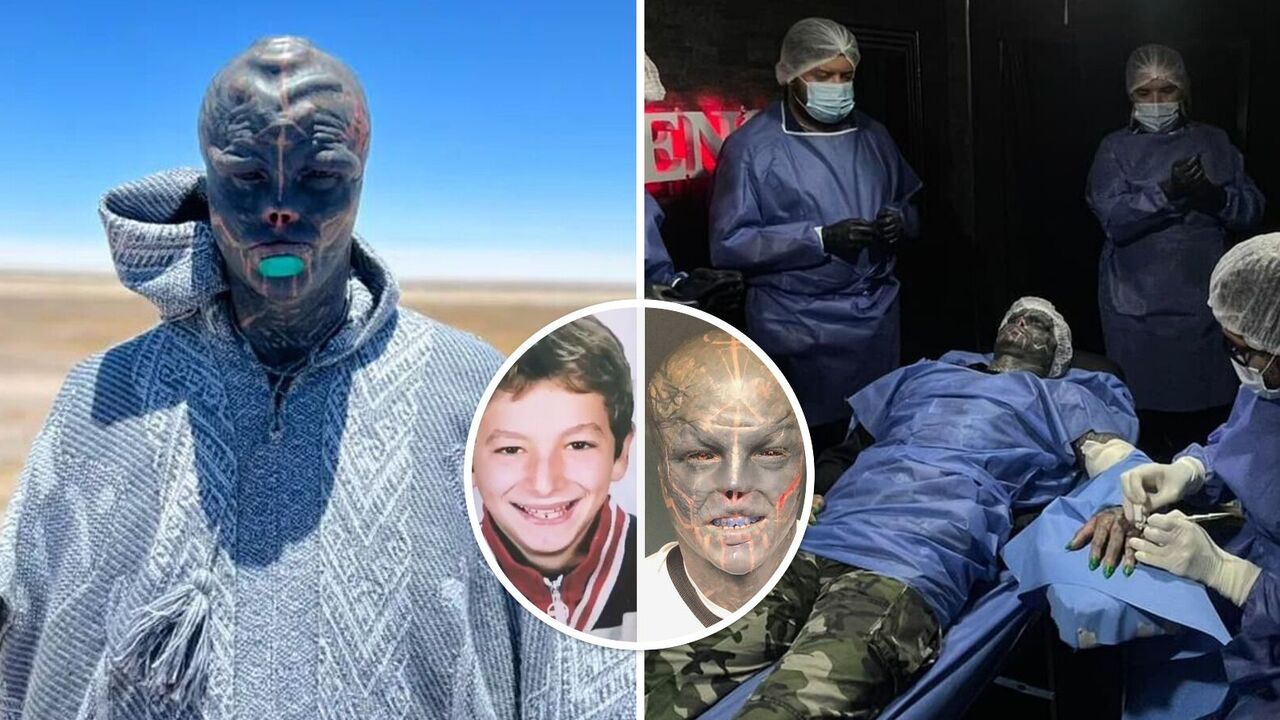 The "Black Alien" without ears and nose showed what he looked like at the age of 13 before numerous surgeries and tattoos. Impressive photos