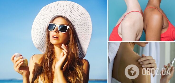 Dlaczego nigdy nie należy złuszczać skóry poparzonej słońcem: dermatolog wyjaśnia zagrożenia