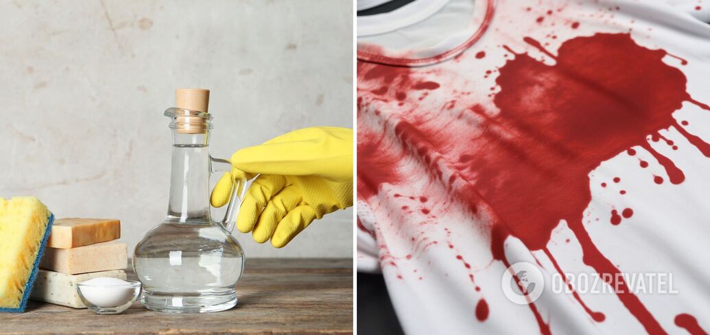 How to Remove Blood Stains from clothing