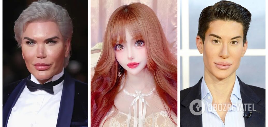 Kopie Barbie i Kena: jak dziś żyją ekscentryczne osoby, które poddają się operacjom plastycznym, aby zmienić się w lalki