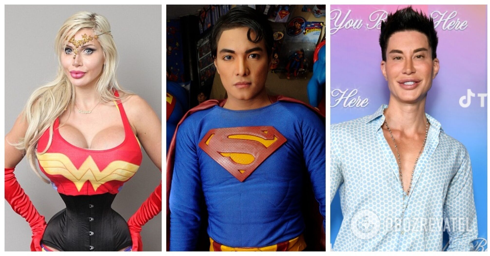 Britney Spears, Ken, lynx: who the victims of plastic surgery wanted to be like. Photo