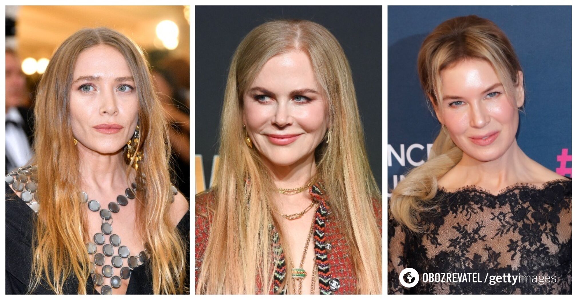 What Kidman, Zellweger and other stars who had facelifts 10 years ago look like now