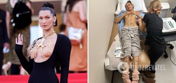 Supermodel Bella Hadid talks about the serious illness she fought for 15 years, showing frightening photos from the hospital