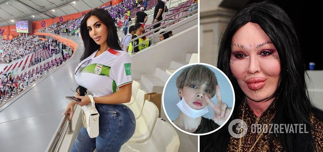 Stars killed by plastic surgery