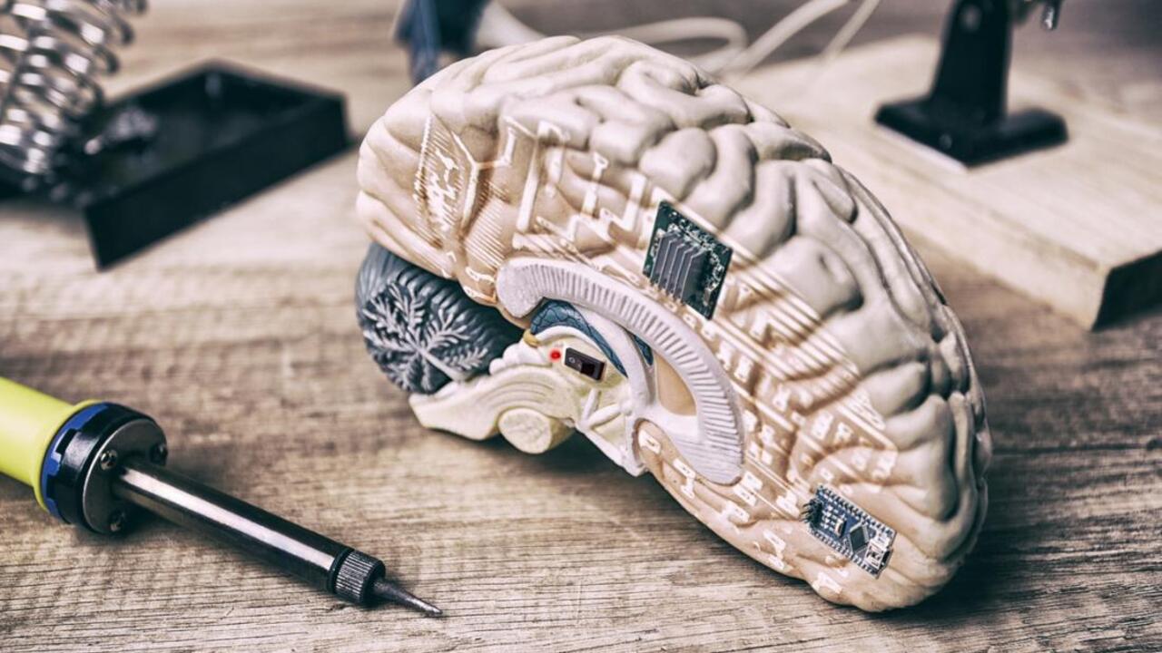 Is the secret to slimness in your head? Brain structure of overweight people differs from the one of slim people