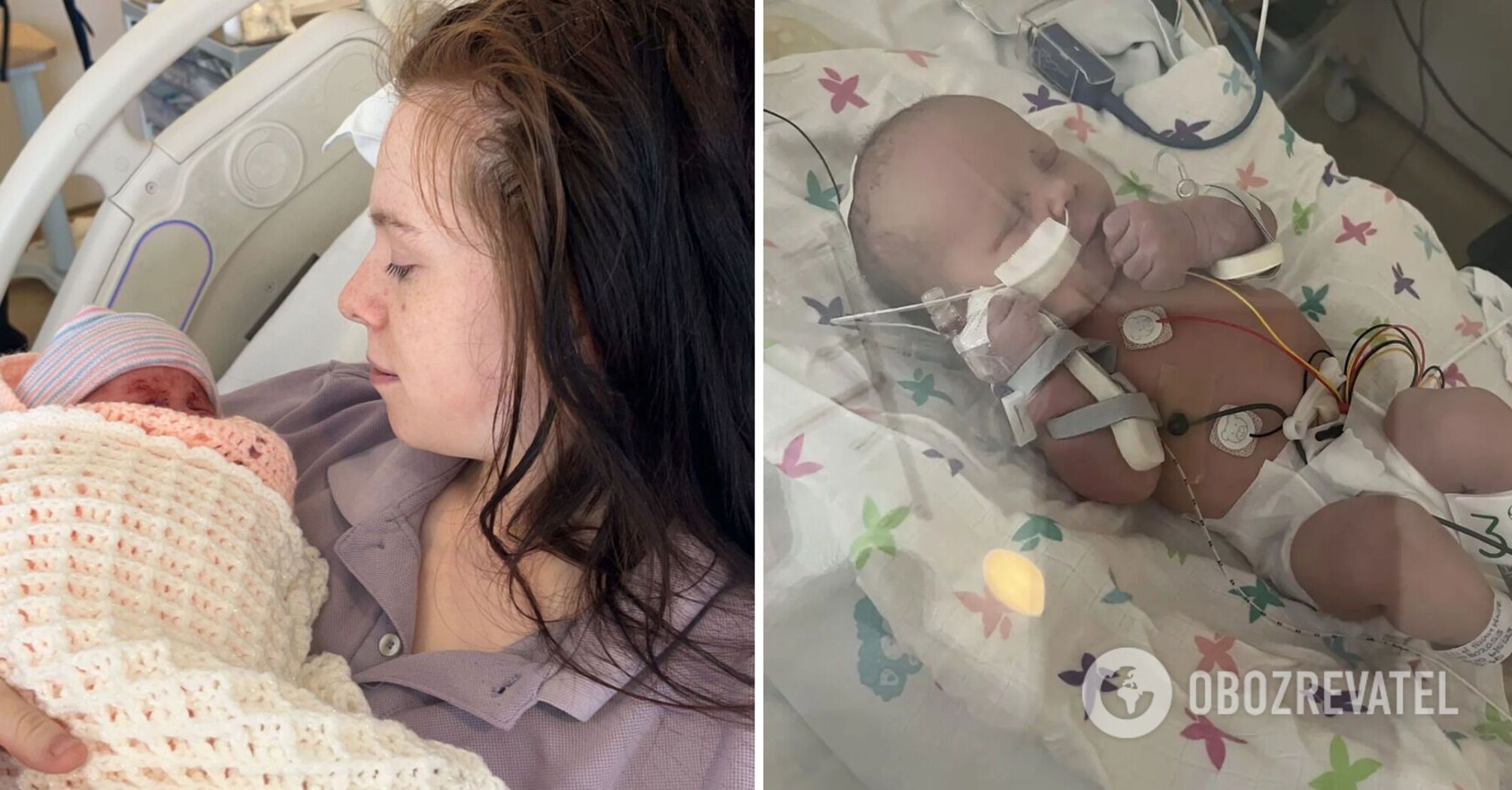 A 19-year-old girl didn't know she was pregnant until a baby's leg came out of her... An incredible story