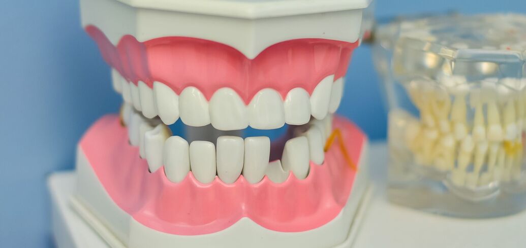 Чого чекати, коли відколовся зуб