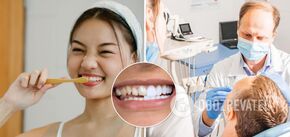 Veneers or your teeth: the dentist named the pros and cons of a Hollywood smile