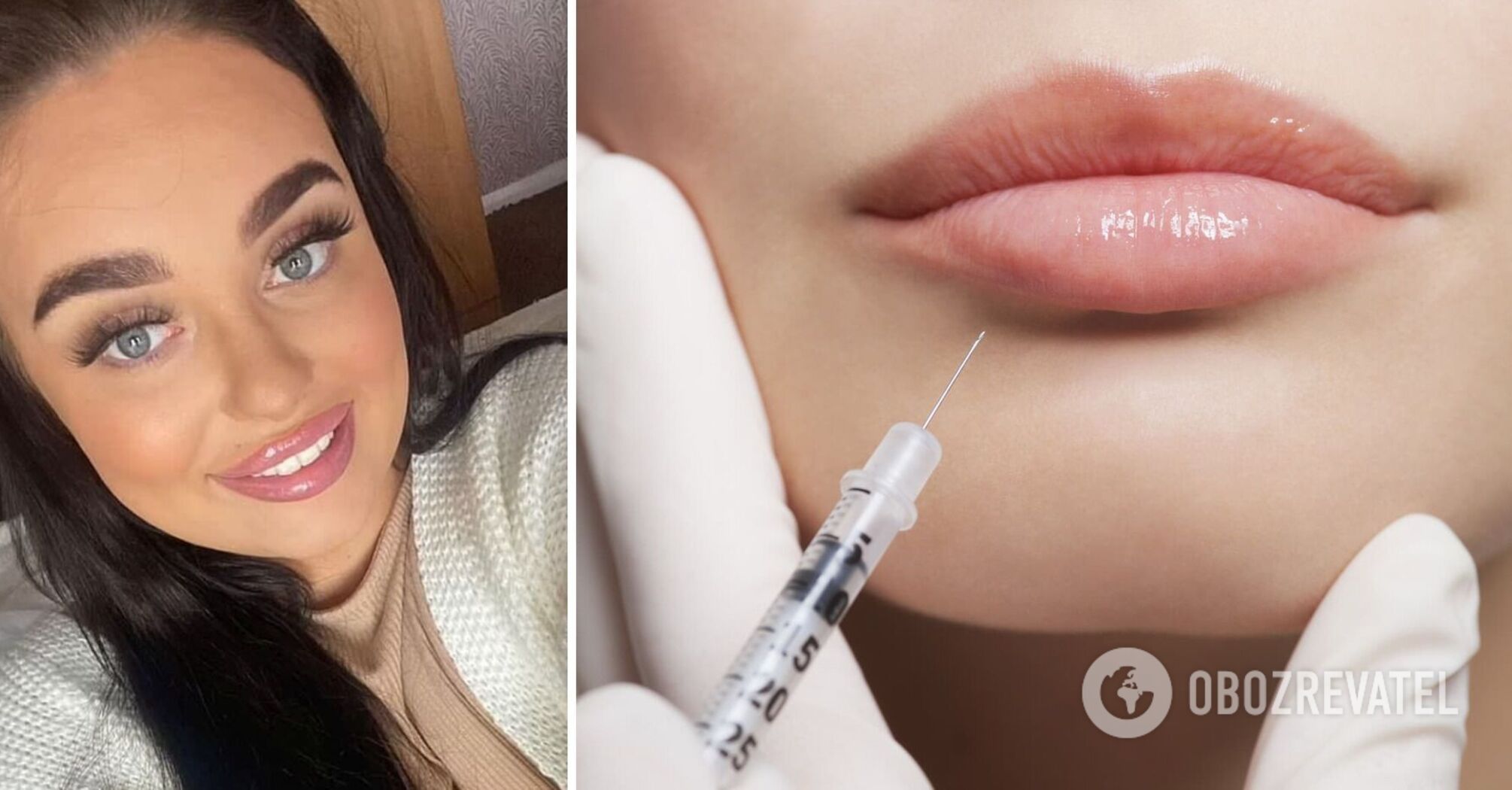 21-letnia Angielka prawie straciła część twarzy po powiększeniu ust. Zdjęcie