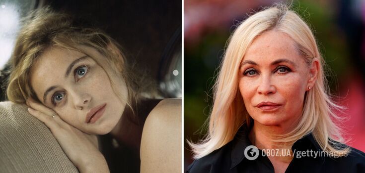 Pump lips are no longer in fashion: 5 stars who unsuccessfully enlarged their lips. Photos