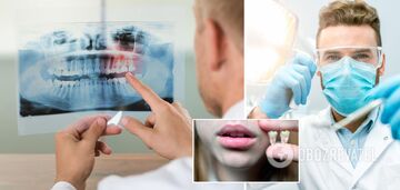 Top 9 little known facts about teeth