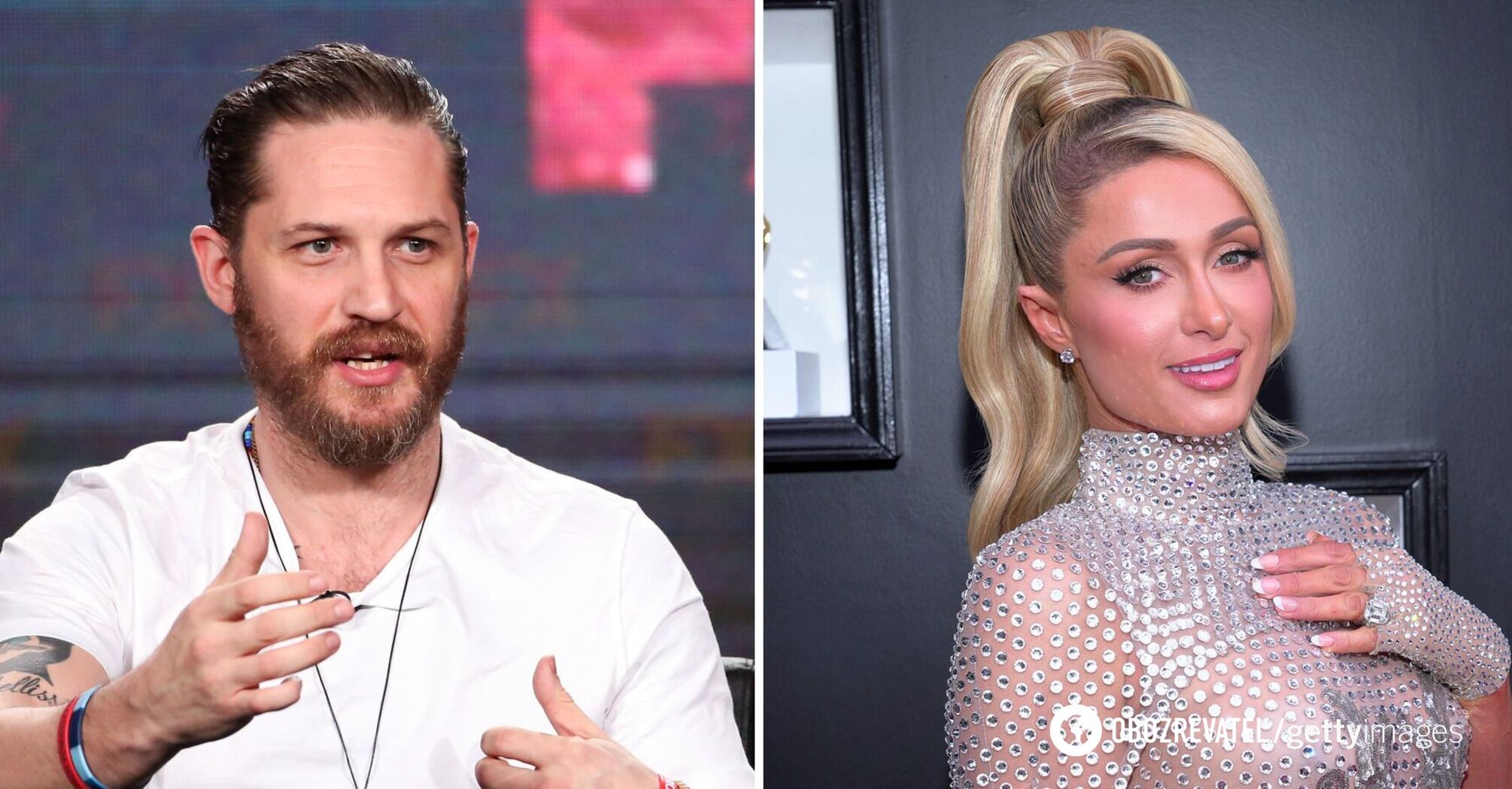 Four nipples, a sword scar, and other details in celebrities' appearance you didn't know about. Photo