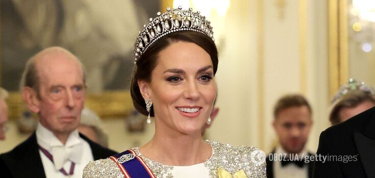 It has become known how Kate Middleton will work after being discharged from the hospital where she underwent abdominal surgery
