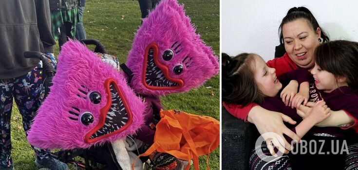 How Callie and Carter, Siamese twins from the United States, look today, after their mother hid them from people. Photo