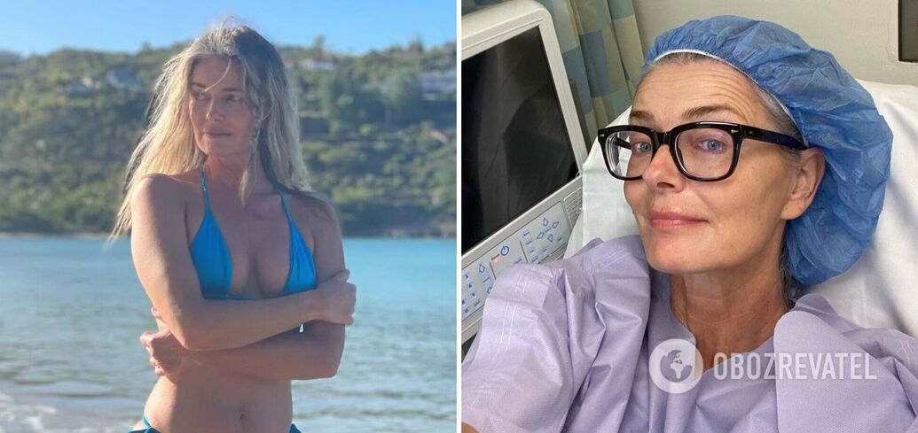 Doctors were "disgusted" to see an X-ray: 90s supermodel Paulina Porizkova underwent surgery after a serious injury